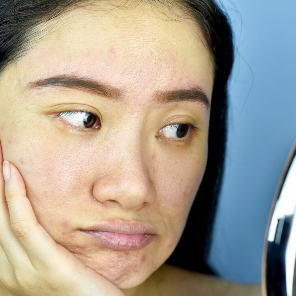 Dull, tired-looking skin