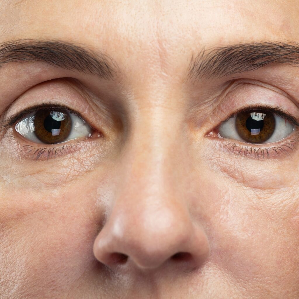 Dull and tired-looking skin