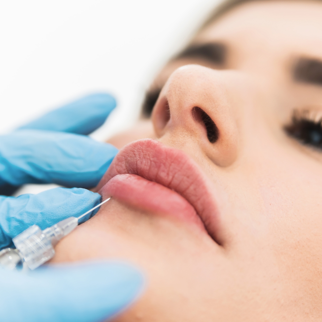 Derma Fillers