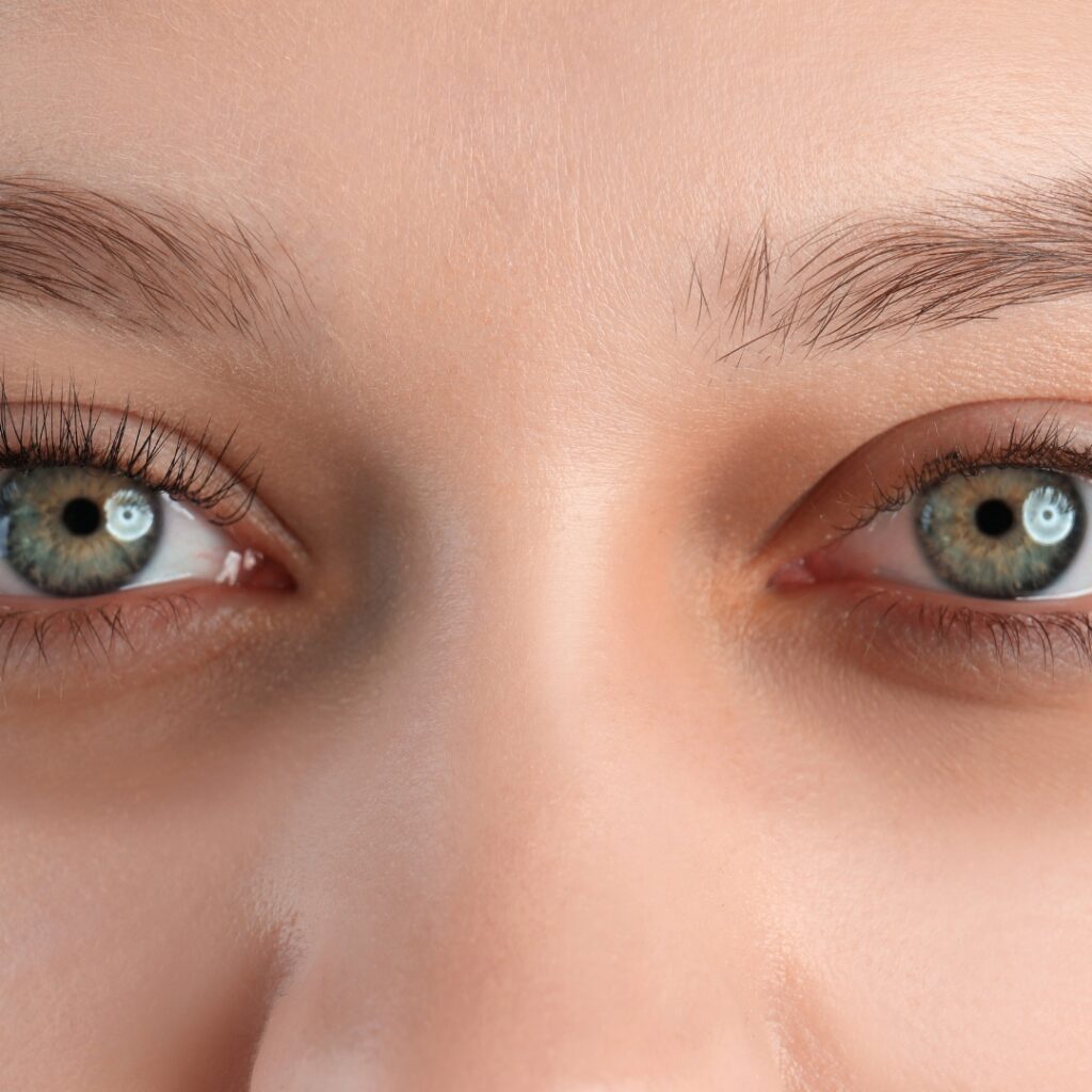 Under Eyes