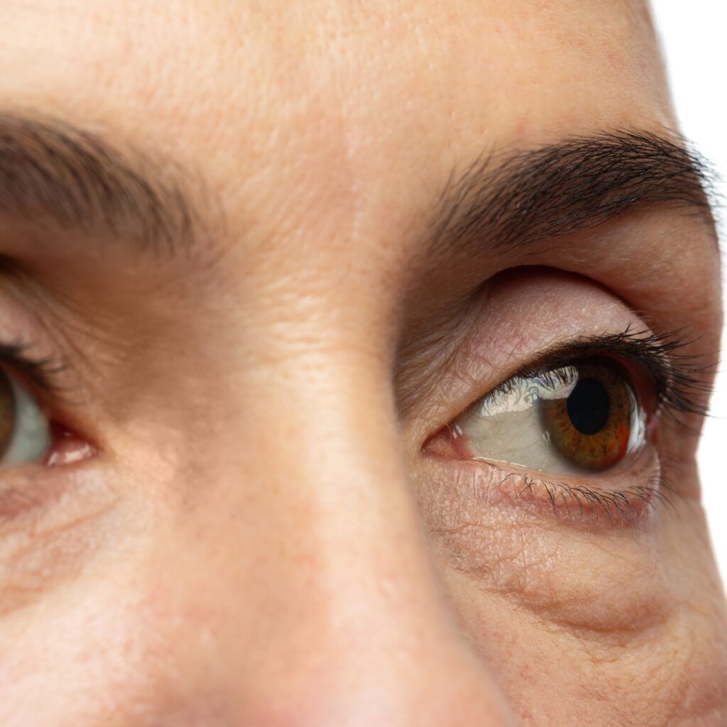 Visible Signs of Aging