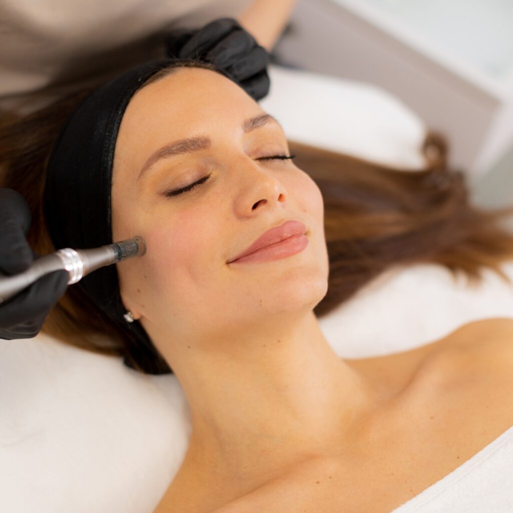 Microneedling