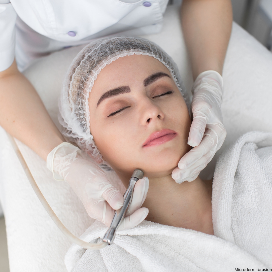 Microdermabrasion