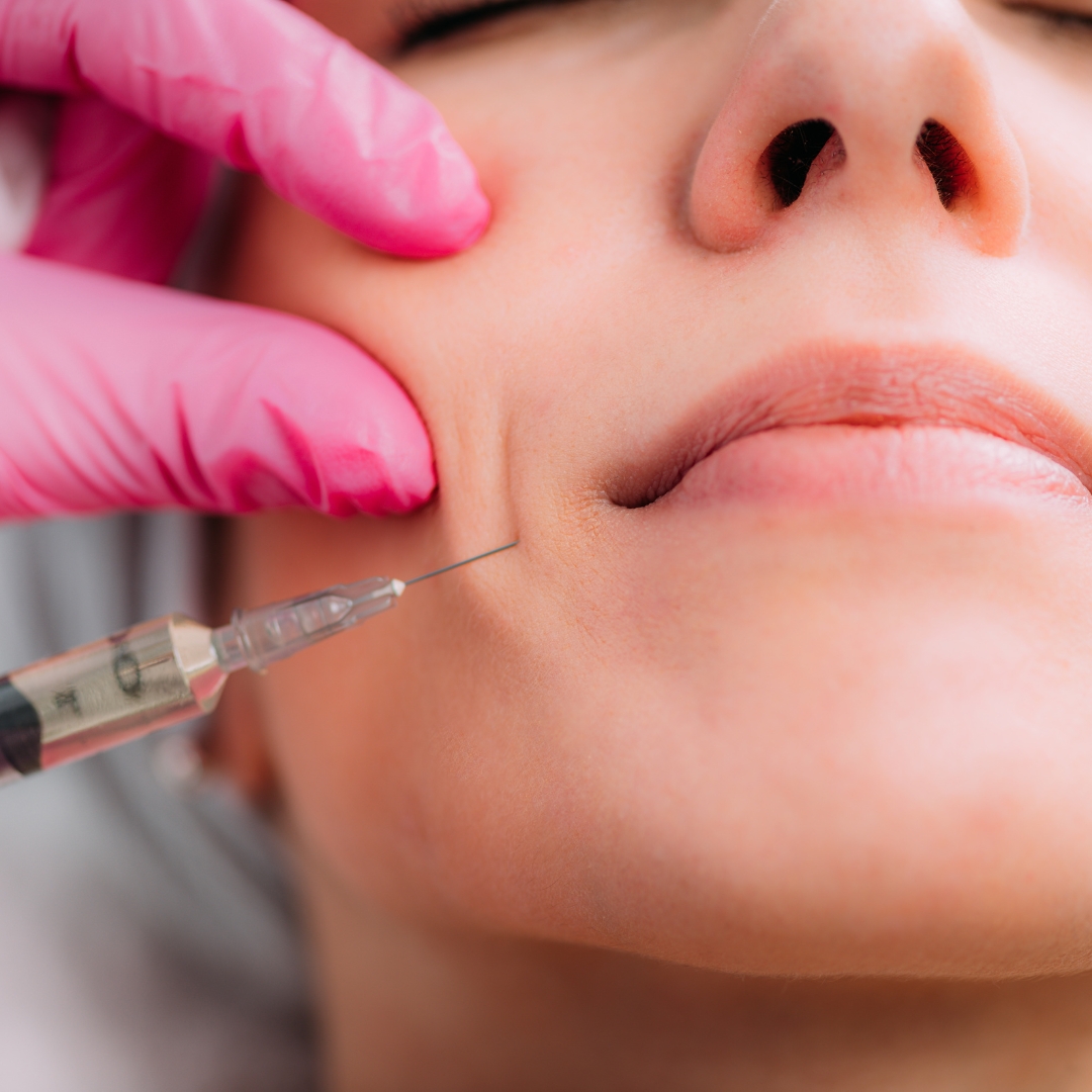 Dermafillers