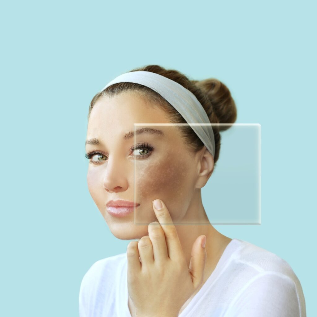 Post-travel skin fatigue