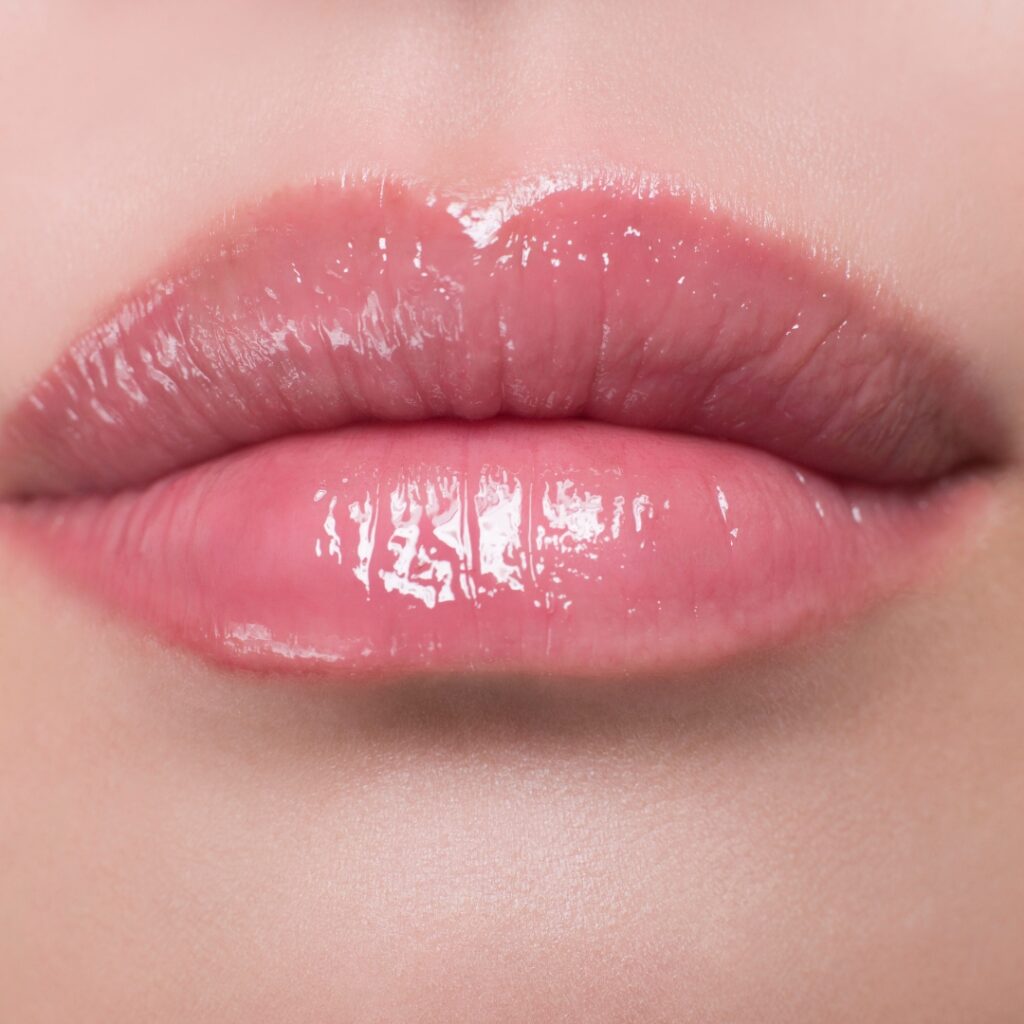 derma fillers lips