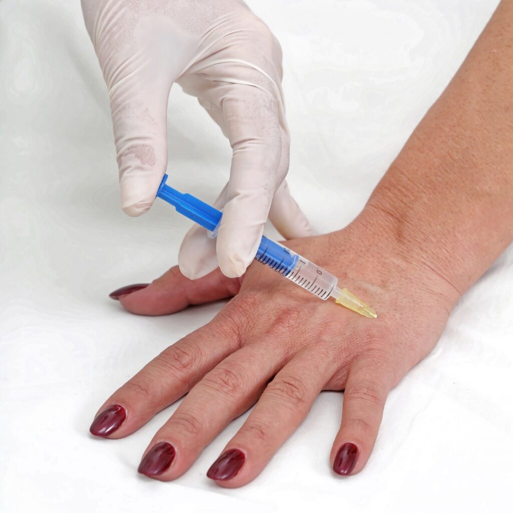 Hands dermafillers