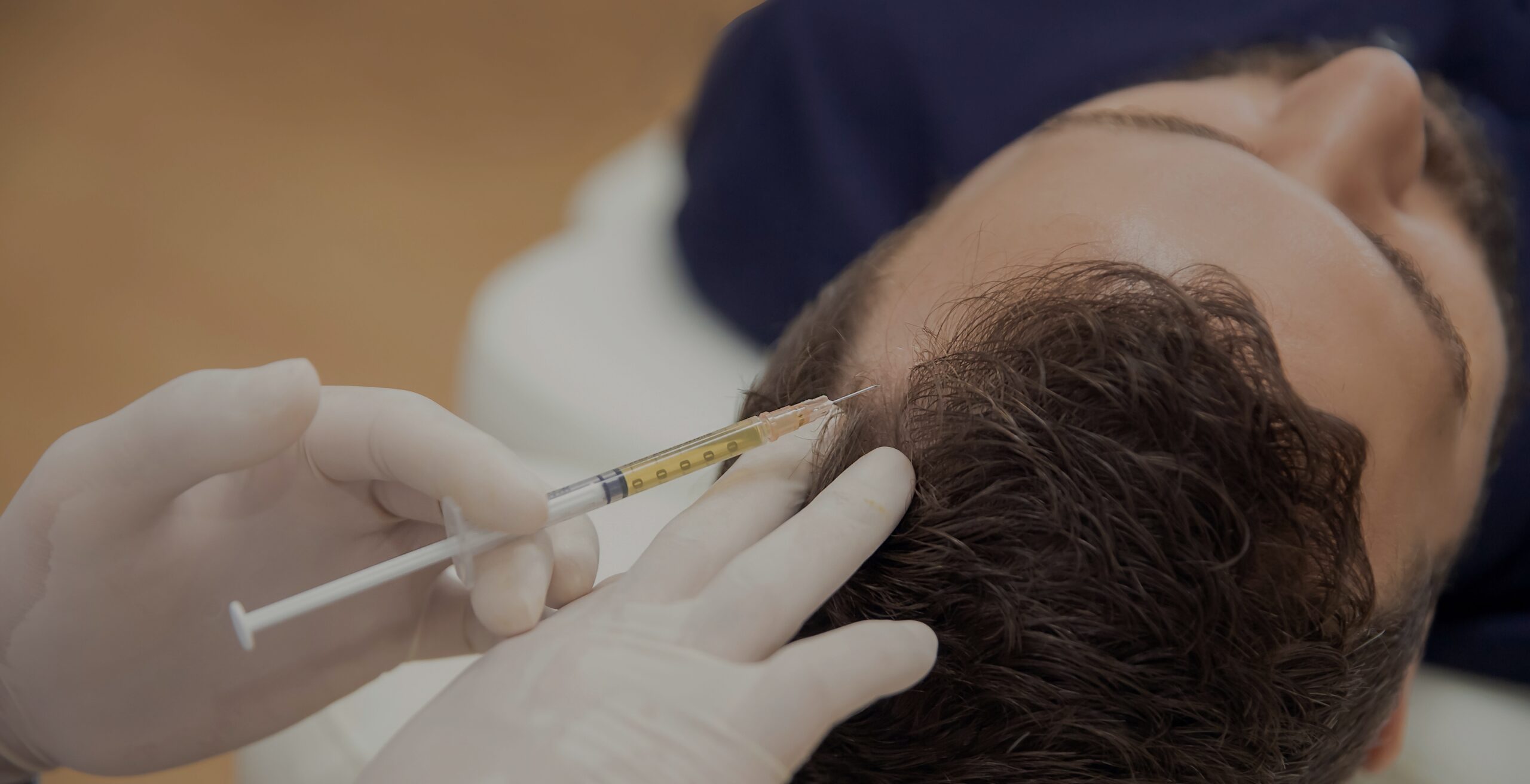 Advanced GFC Treatment