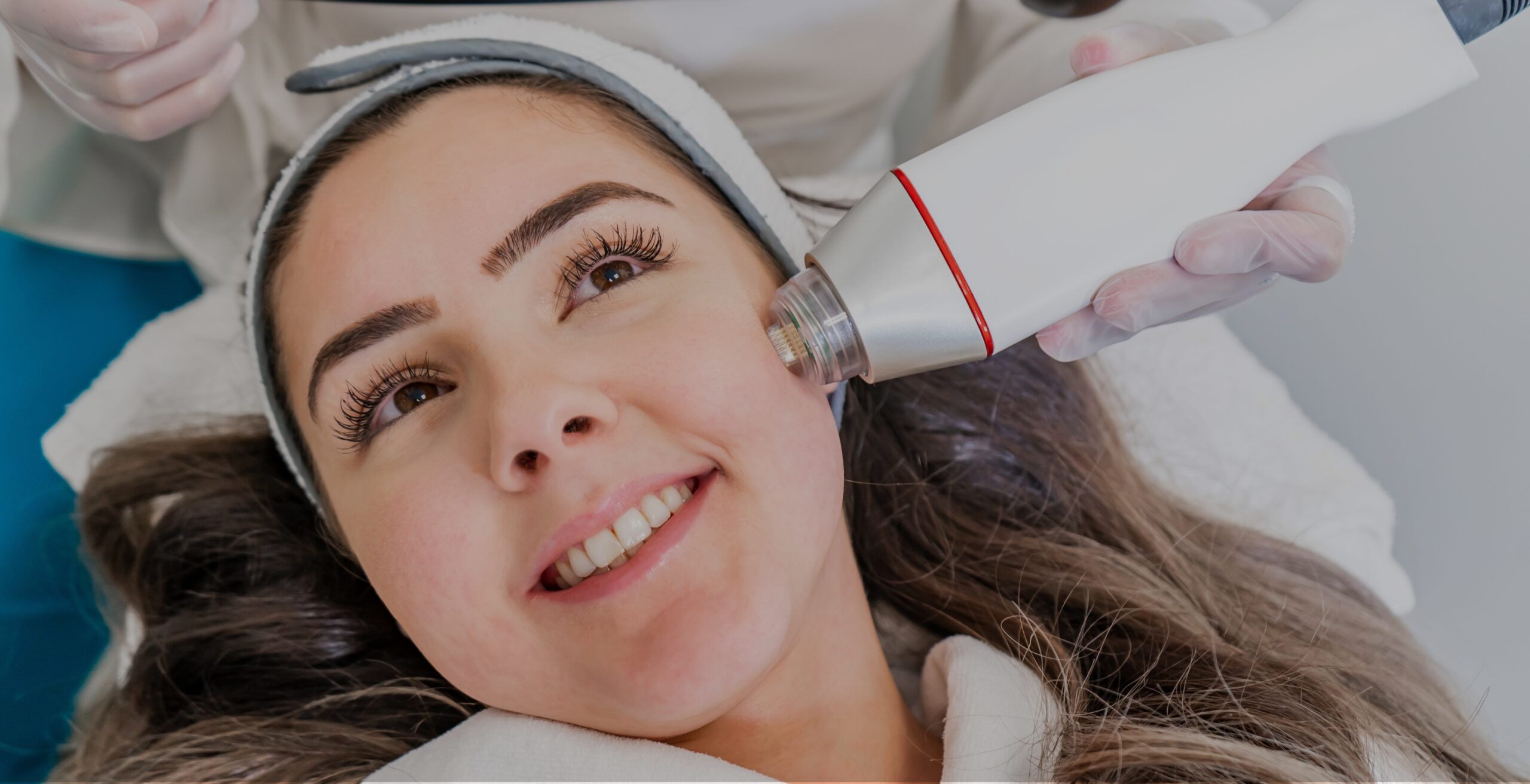 Radiofrequency Skin Tightening