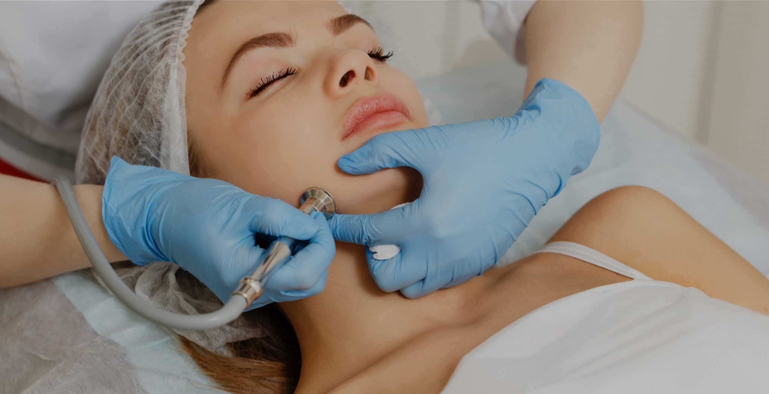 Microdermabrasion treatment near me