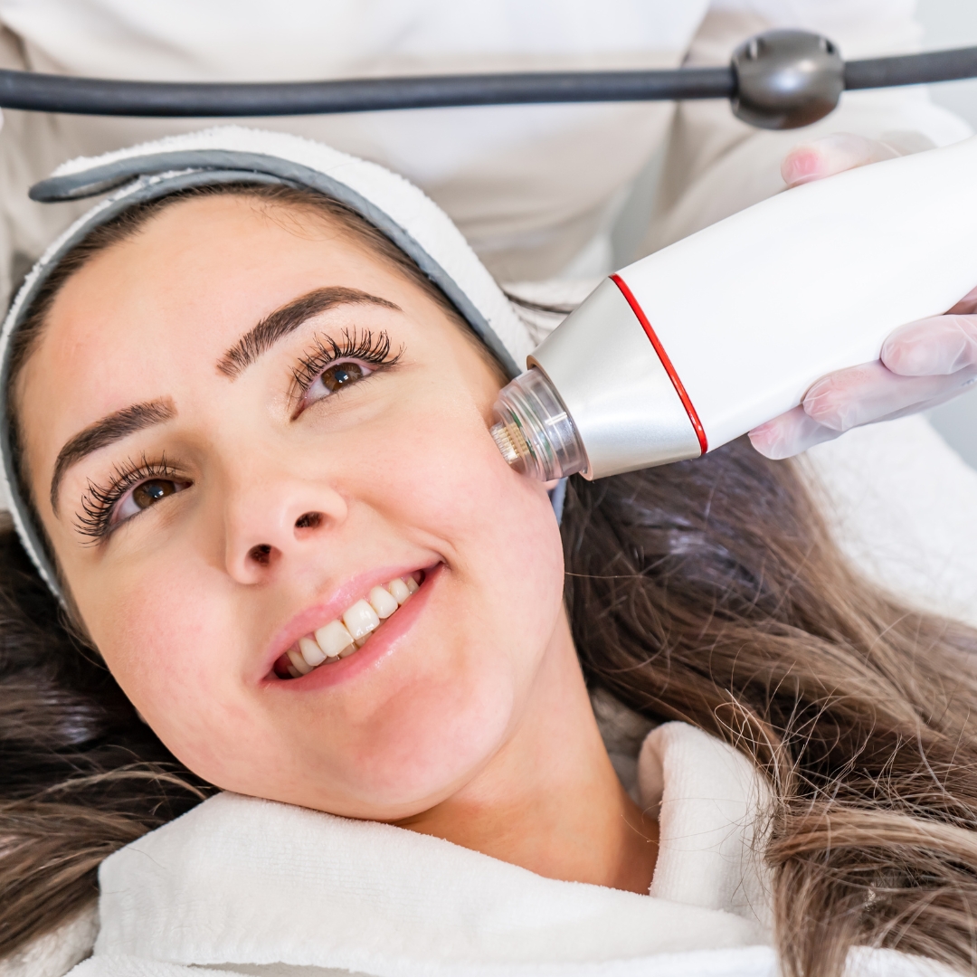 Radiofrequency Skin Tightening