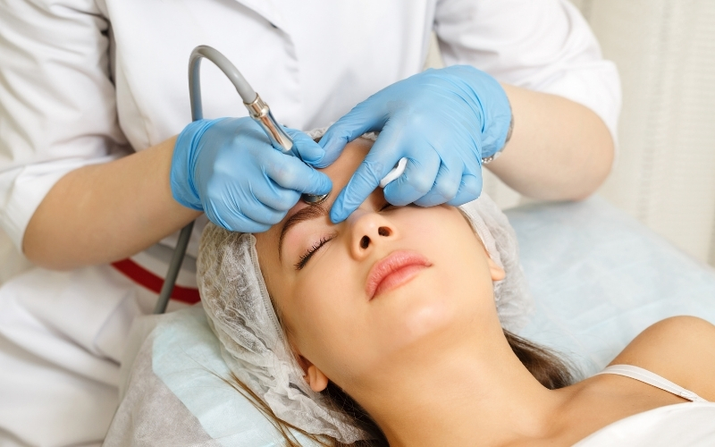 dermabraison treatments during