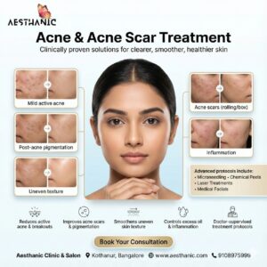 Acne Scar Treatment in Kothanur