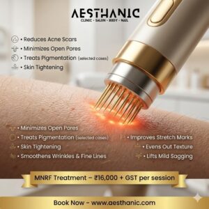 MNRF Treatment in Kothanur