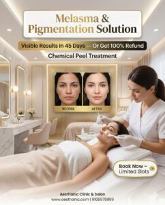 Melasma & Pigmentation Treatment in Kothanur
