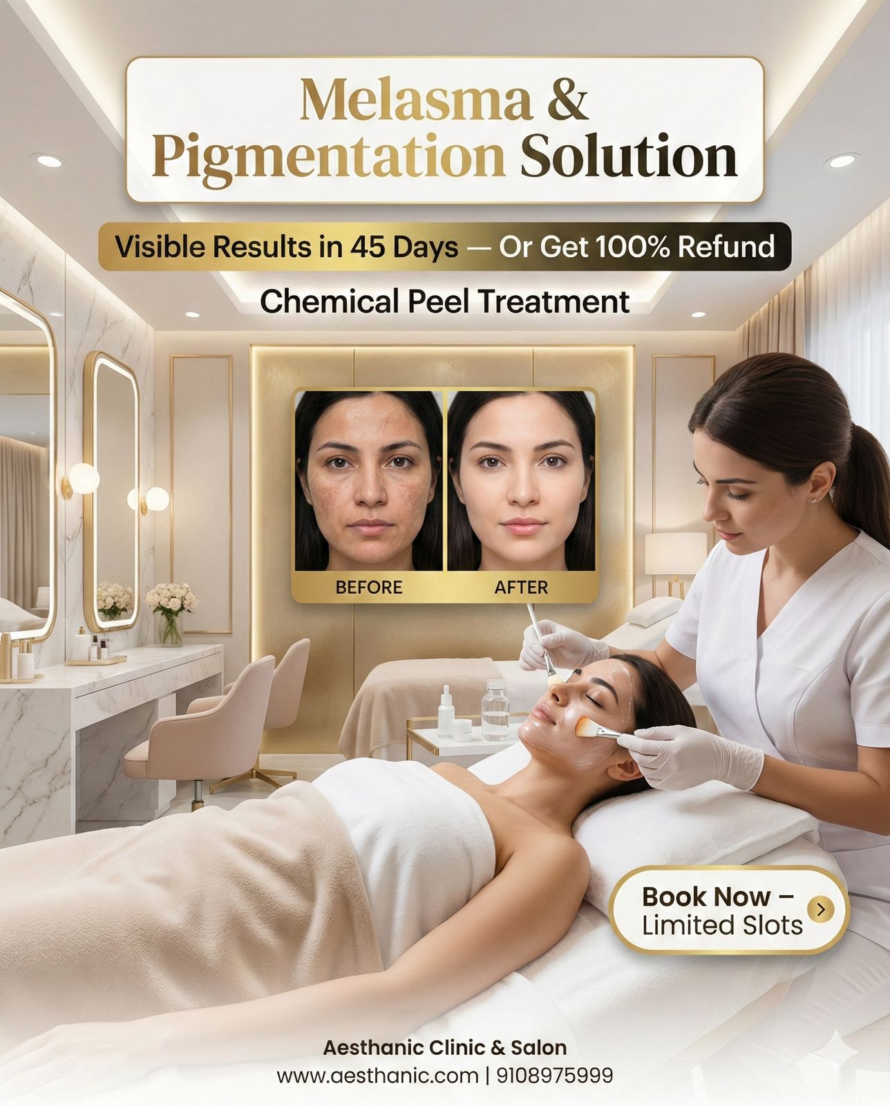 Melasma & Pigmentation Treatment in Kothanur