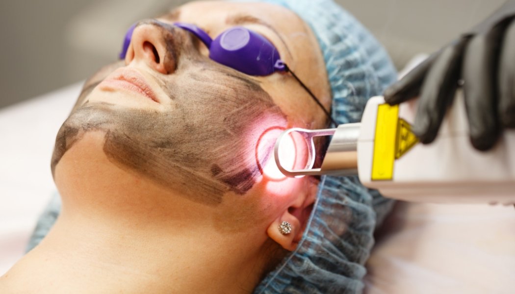 Pigmentation Treatment