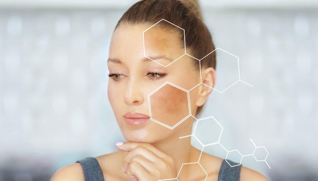 Skin Lightening Treatment