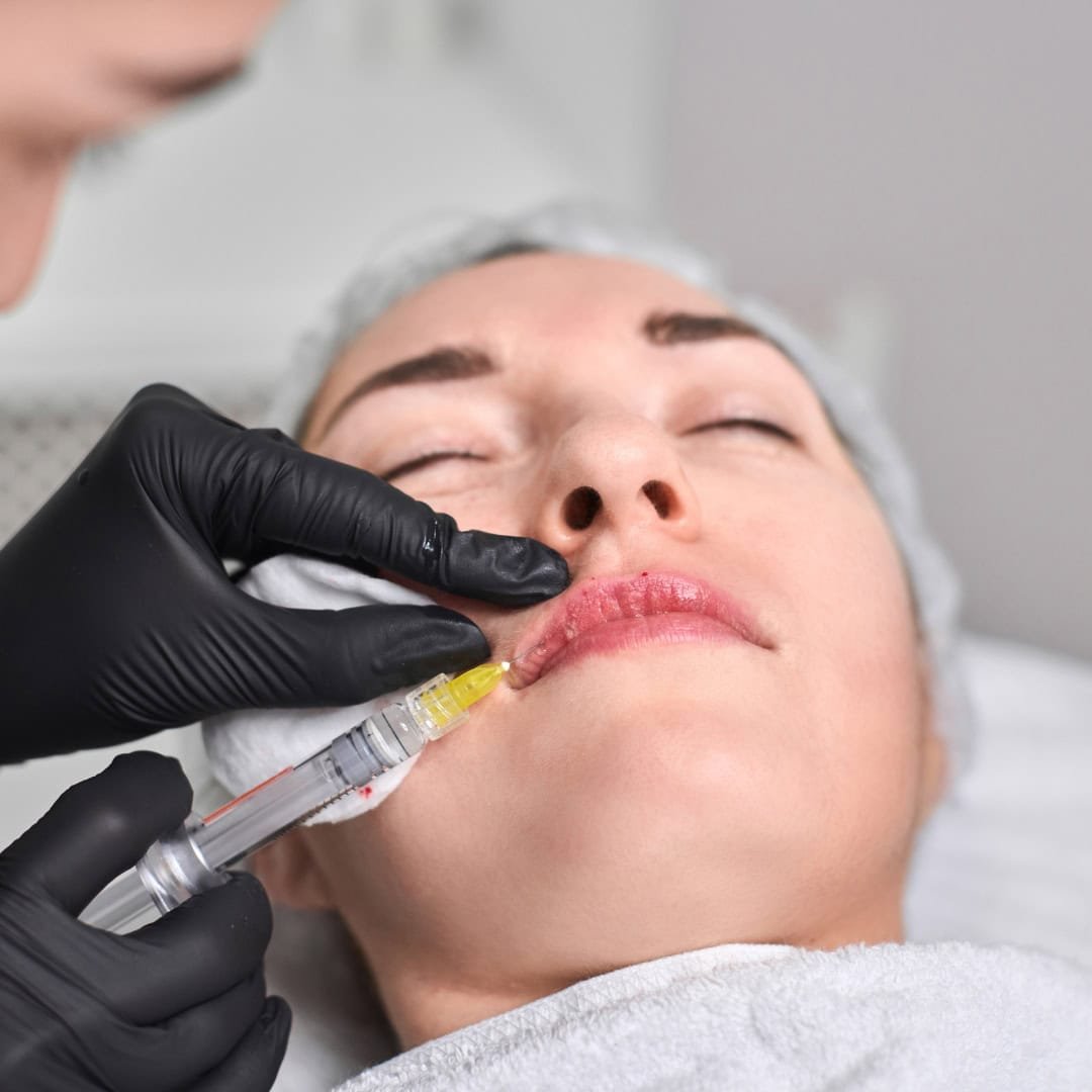 Derma fillers in hennur