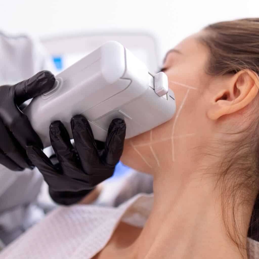 hifu treatment in kothanur