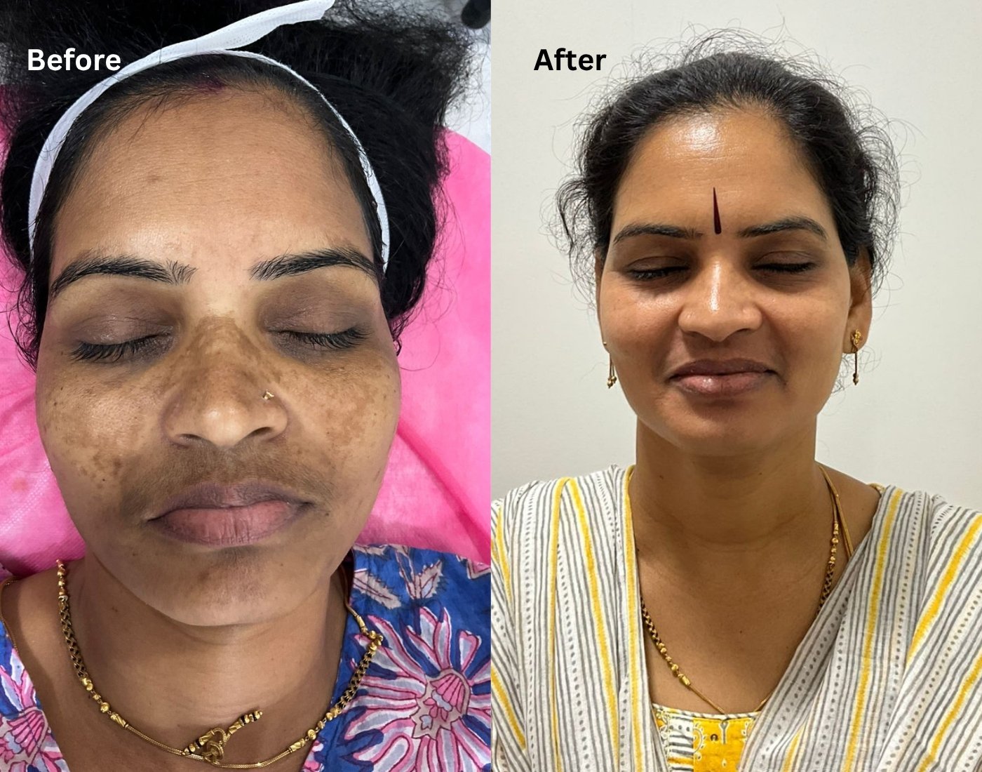 before after aesthanic