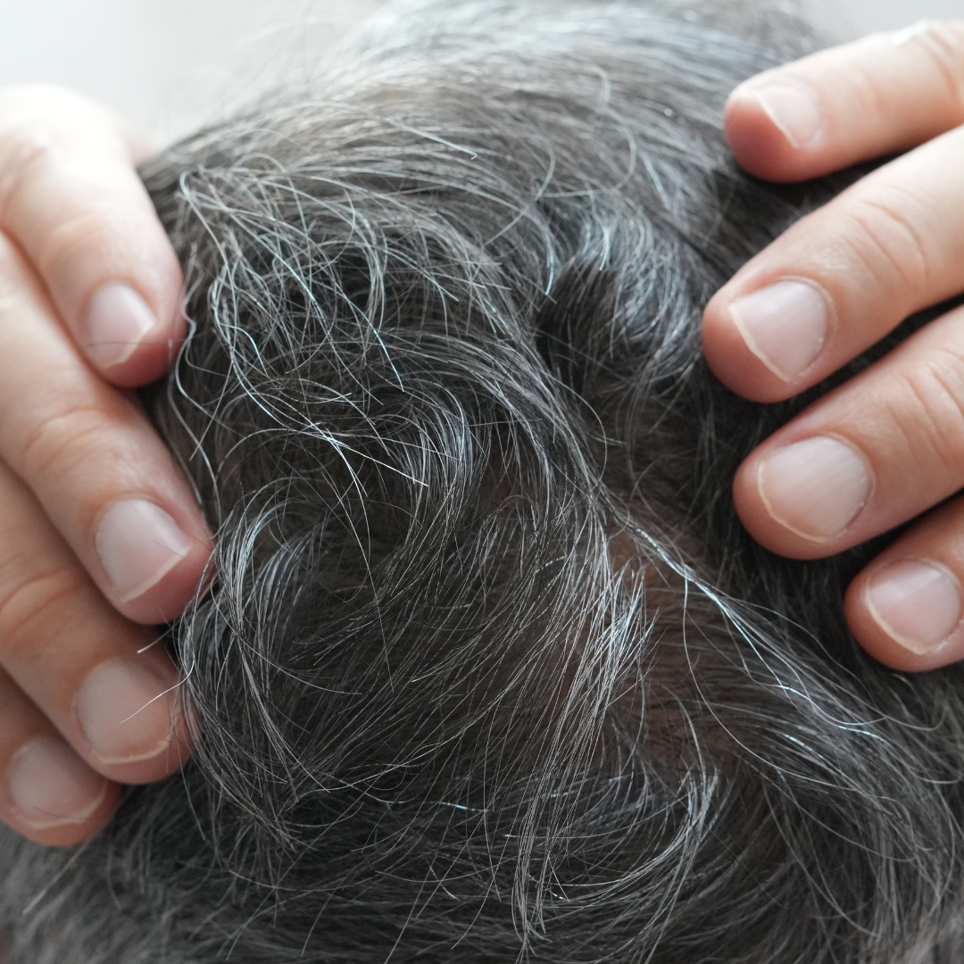 GFC vs PRP hair growth factor comparison