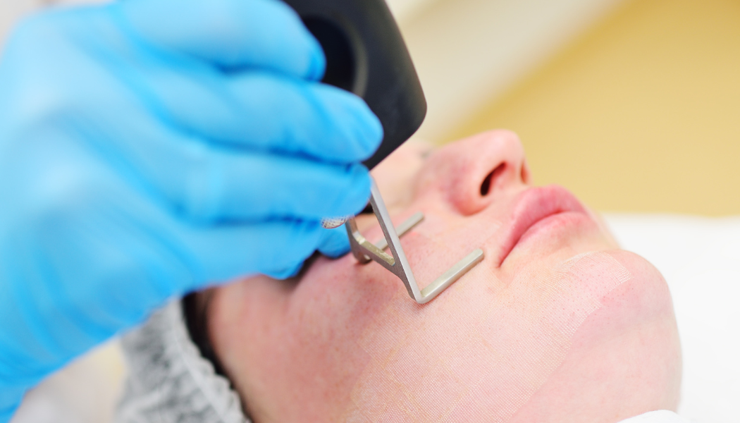 Fractional Laser